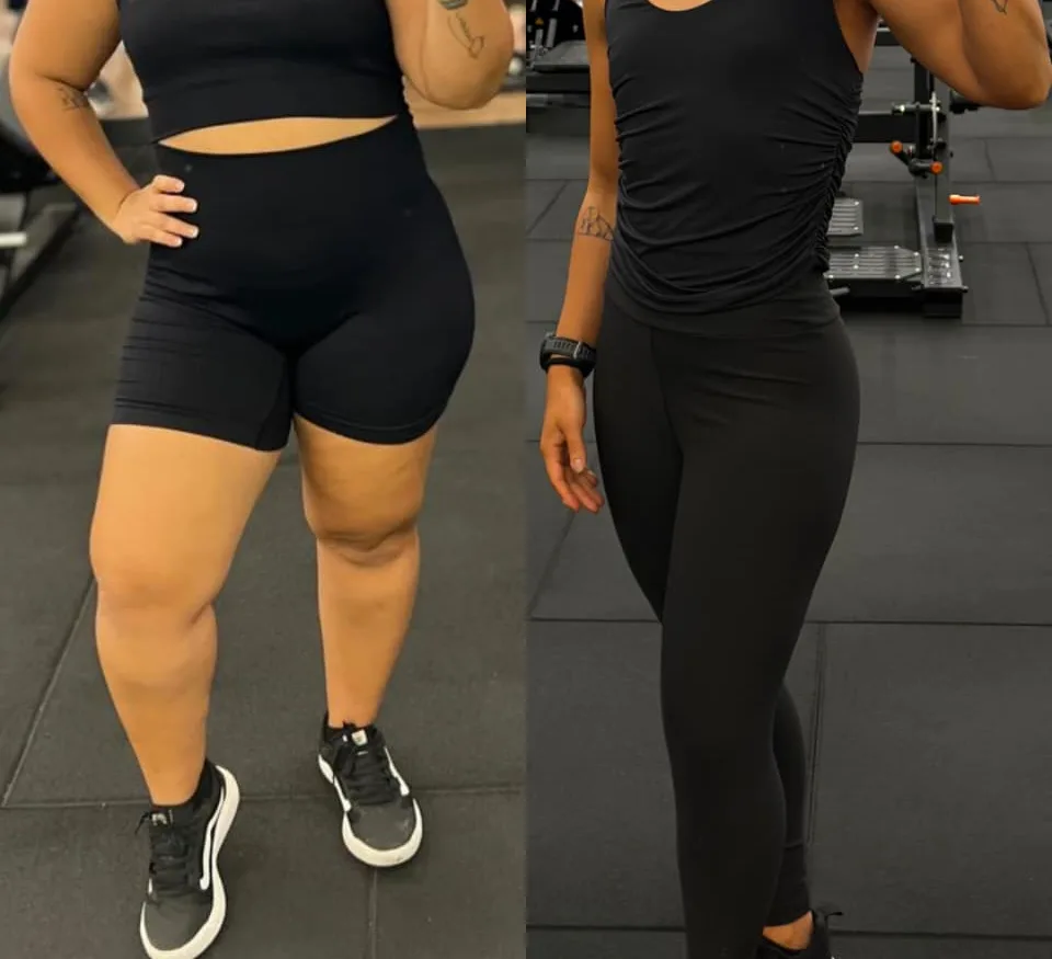 Antes e depois de uma aluna do Método LGN após 1 ano e meio (emagrecimento), com o rosto fora da foto