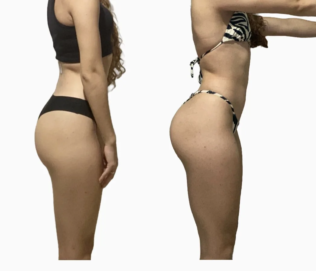 Antes e depois de uma aluna do Método LGN após 1 ano (hipertrofia), com o rosto fora da foto