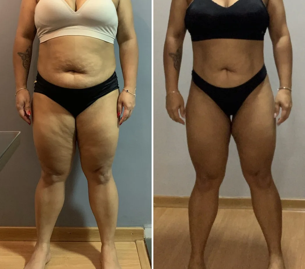 Antes e depois de uma aluna do Método LGN após 10 meses (emagrecimento), com o rosto fora da foto