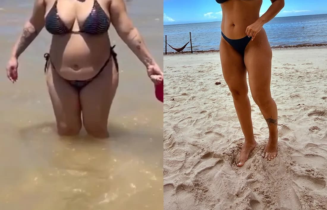Antes e depois de uma aluna do Método LGN após 5 meses (emagrecimento), com o rosto fora da foto