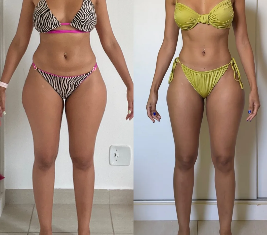 Antes e depois de uma aluna do Método LGN após 3 meses (emagrecimento), com o rosto fora da foto