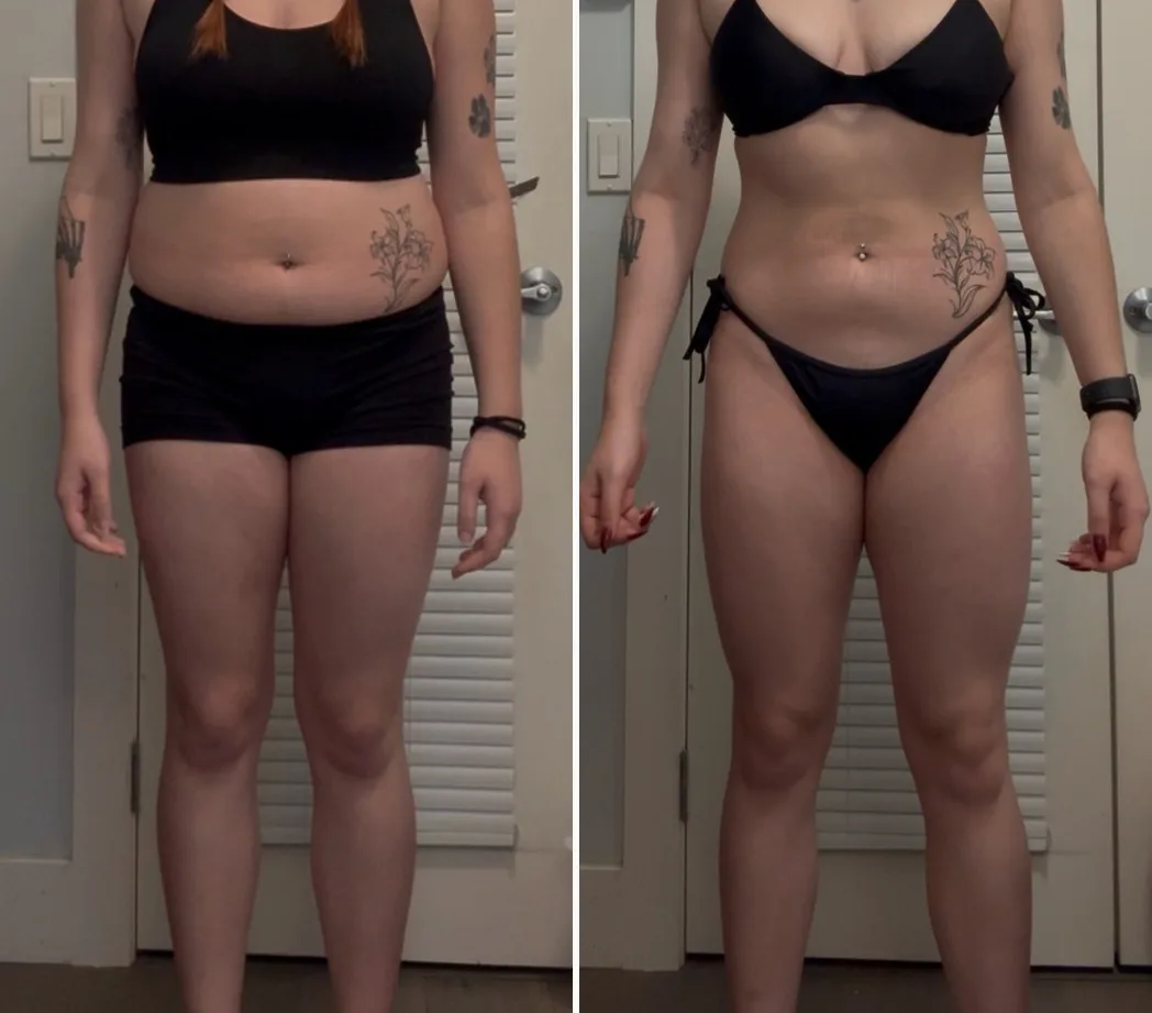 Antes e depois de uma aluna do Método LGN após 6 meses (emagrecimento), com o rosto fora da foto