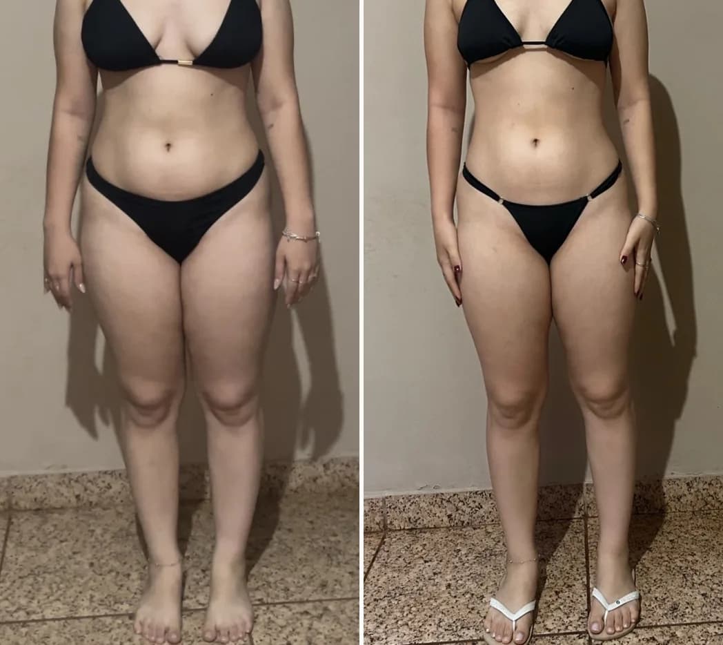 Antes e depois de uma aluna do Método LGN após 3 meses (definição), com o rosto fora da foto